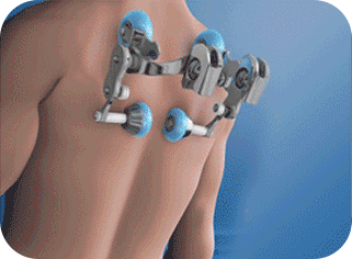 gif-1